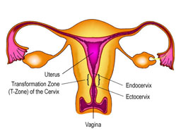 cervical cancer zone